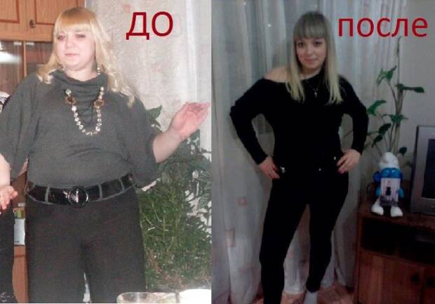 Хирургия похудения (бариатрическая хирургия) и лечения сахарного диабета в Одессе на кафедре хирургии № 1 ОНМУ. Медицина, здоровье > Похудение, диетолог, Одесса