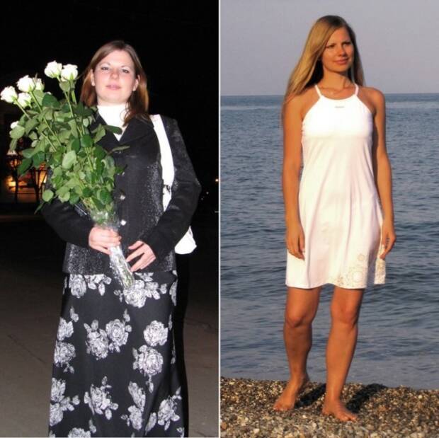 Хирургия похудения (бариатрическая хирургия) и лечения сахарного диабета в Одессе на кафедре хирургии № 1 ОНМУ. Медицина, здоровье > Похудение, диетолог, Одесса