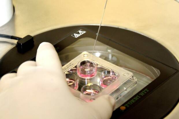 Медицинский центр “АКАДЕМИУМ” - лечение бесплодия. Медицина, здоровье > Лечение бесплодия, Одесса