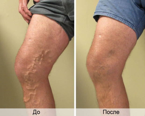 Медицинский центр лечения варикоза любой стадии. Медицина, здоровье > Медицинские и оздоровительные центры, Одесса