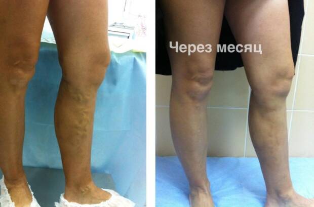 Медицинский центр лечения варикоза любой стадии. Медицина, здоровье > Медицинские и оздоровительные центры, Одесса