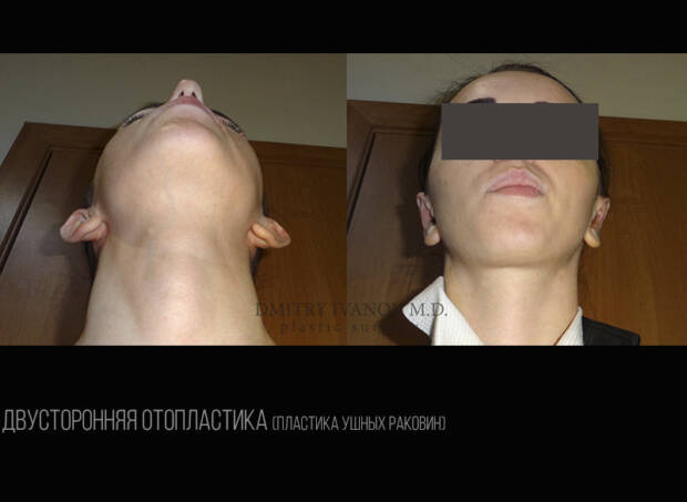 Пластический хирург Иванов Дмитрий Владимирович. Медицина, здоровье > Пластическая хирургия, Одесса