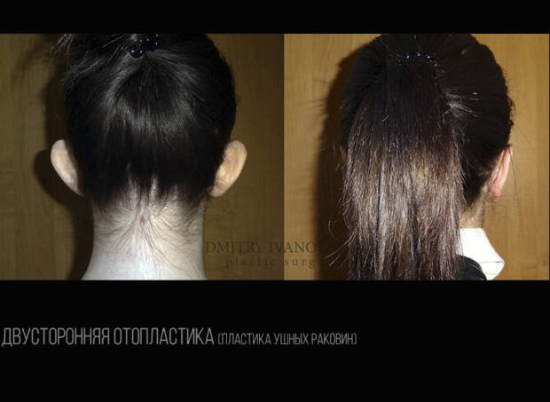 Пластический хирург Иванов Дмитрий Владимирович. Медицина, здоровье > Пластическая хирургия, Одесса