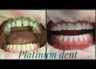 Platinum dent, эстетическая стоматология. Медицина, здоровье > Стоматологии, Одесса