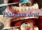Platinum dent, эстетическая стоматология. Медицина, здоровье > Стоматологии, Одесса