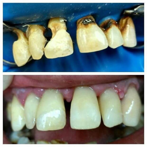 Стоматолог, доктор Назаренко Ростислав Алексеевич. Медицина, здоровье > Стоматологии, Одесса