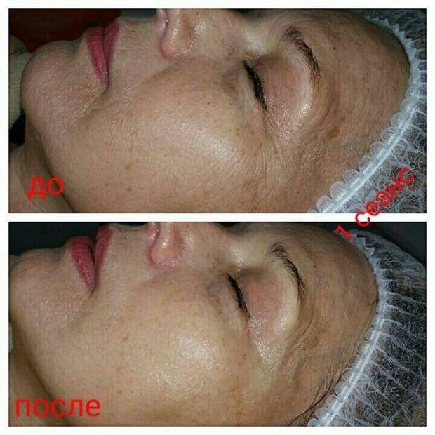 Ухоженная Я, косметика. Салоны красоты, солярии, сауны, SPA > Косметология, Одесса