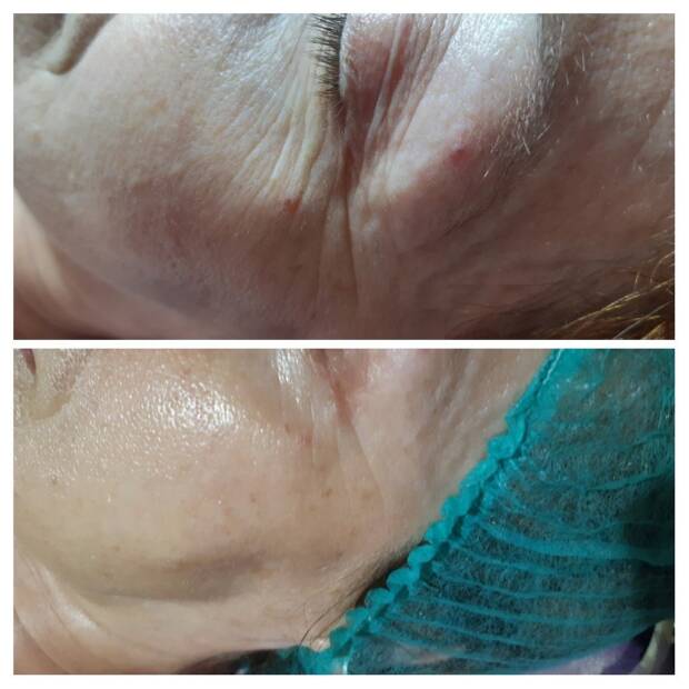 Косметология, частный кабинет Анжелы Артемчук. Салоны красоты, солярии, сауны, SPA > Косметология, Одесса