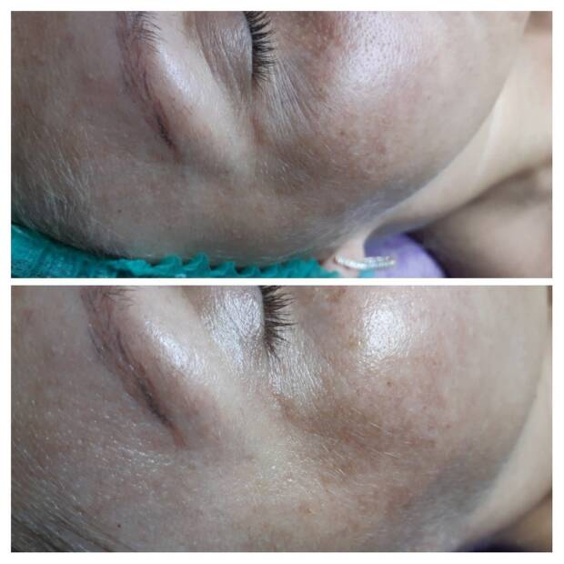 Косметология, частный кабинет Анжелы Артемчук. Салоны красоты, солярии, сауны, SPA > Косметология, Одесса