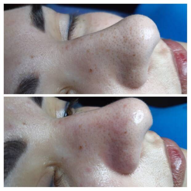 Косметология, частный кабинет Анжелы Артемчук. Салоны красоты, солярии, сауны, SPA > Косметология, Одесса