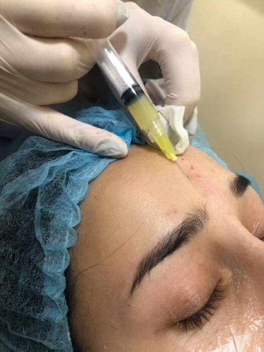 Косметология в Laser ice. Салоны красоты, солярии, сауны, SPA > Косметология, Одесса