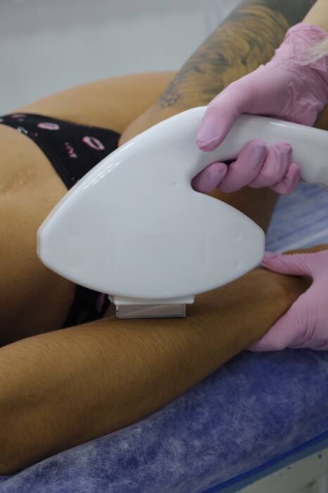 Косметология в Laser ice. Салоны красоты, солярии, сауны, SPA > Косметология, Одесса